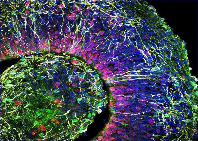 【現実】研究室で培養している『ミニブレイン』から未熟児レベルの人間の脳波が観測された模様